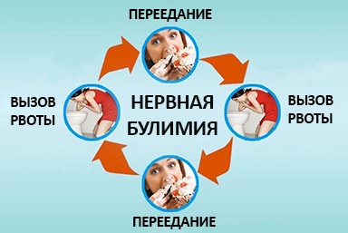 Лечение булимии в Знаменске